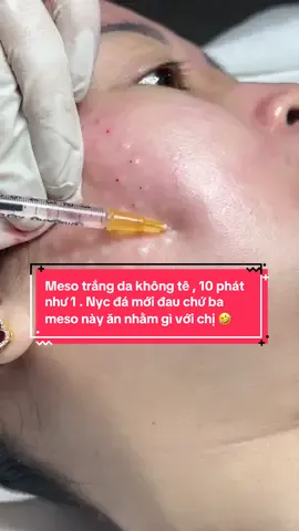 Meso trắng da không tê , 10 phát như 1 . Nyc đá mới đau chứ ba meso này ăn nhằm gì với chị 🤣#xuhuong #meso #viralvideo #spabienhoa #đàotaohocvien 