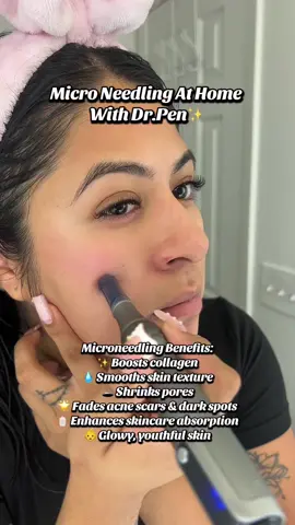 Save your coins! 😍  #drpen #microneedling #facial #skinrejuvenation #foryou 