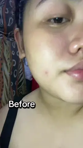 #retinol #fyppppppppppppppppppppppp #fypage #fypシ゚ #retinolcream 