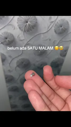 Masih juga anak baruu bracket udh copot yaampun😫🙃 #braches #behelstory #audydental #brachesjourney #behelgigi