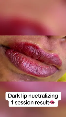 #fypage #ugandatiktok🇺🇬 #dubai_dxb_uae #eritreantiktok #ethiopian_tik_tok🇪🇹🇪🇹🇪🇹🇪🇹 @Aleybrow n aesthetics 