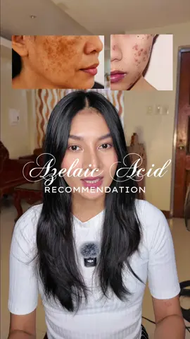 Azelaic acid recommendation. Plus, anong magandang ipartner sakanya. 😉  -------------------- 🏷️ #azelaicacid #hyperpigmentation #darkspots #acnemarks #skincare 