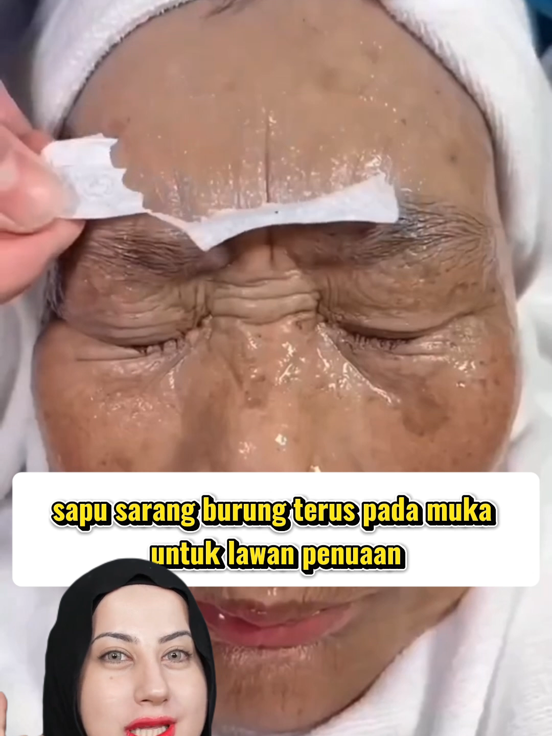 3 minggu je, kedut yang lama bertahun pun makin pudar #serummuka #serumwhitening #kulitglowing #awetmuda  #pudarkerut #fypmalaysia SarangBurung #SerumKiss