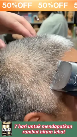 8.29 wsz ML hfwsp.💥 Rambut beruban di bahagian atas epala⁉ Akar rambut beruban⁉ Kehilangan seikat rambut ketika menyikat rambut⁉ 👉 Cuba suplemen rambut hitam ini sekarang 🧐 [Sangat disyorkan oleh pakar] 👍 Mengandungi ekstrak herba seperti mulberi hitam, serigala hitam, beras hitam, habbatus sauda dan bahan-bahan semula jadi 💯 Sasaran rambut 💯 ively memulihkan rambut hitam ✅ Mengembalikan kilauan muda anda 🌈 🥰 Hasil dapat dilihat dalam tujuh hari Search Malaysia tiktok Mall: Balance and Wellness Center Search the store name to buy-634316