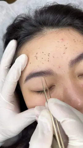 Chân mày sợi sau bong 4 ngày . #xuhuong #pmuartist #pmubrows #pmu #tattoo #academia #phunxamtunhien #phunxamphongthuy #lamdepkhongkho #lamdep 