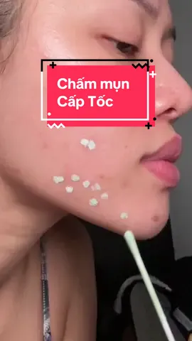 Ko dám đi đâu gần 2 tháng nay. Giờ trộm vía nhiều gòi 😭 #linhbaeli #gọitêntuilàbâyli #reviewlamdep #chammun #byebyeblemish 