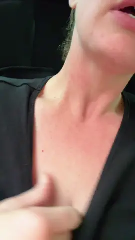 What helps you the most for MCAS flares from chemicals? I need to know!!! #MCAS #histamineintolerance #ehlersdanlos #allergy #medicaltiktok 