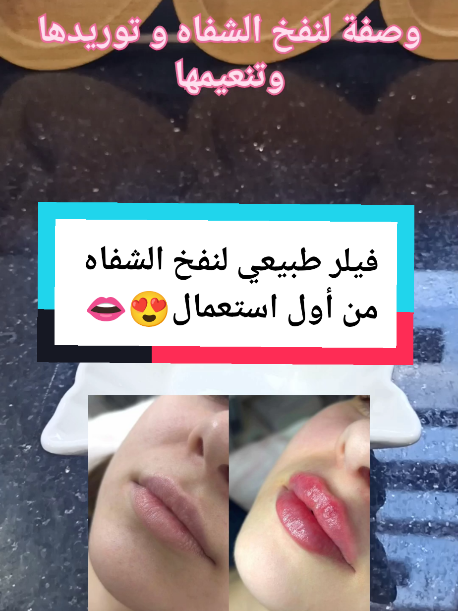 وصفة لنفخ الشفاه  البديل الطبيعي للفيلر توريد الشفاه ضع هذه الوصفة للحصول على شفاه منفوخة و وردية #نفخ_شفايف #فيلر_شفايف #فيلر_طبيعي #fouryou #fyp 