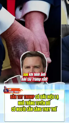 CHẲNG LẼ ÔNG TRUMP CÓ CHUYỆN THẬT RỒI SAO? #LearnOnTikTok #fyp #viral #xuhuong #tintuc         