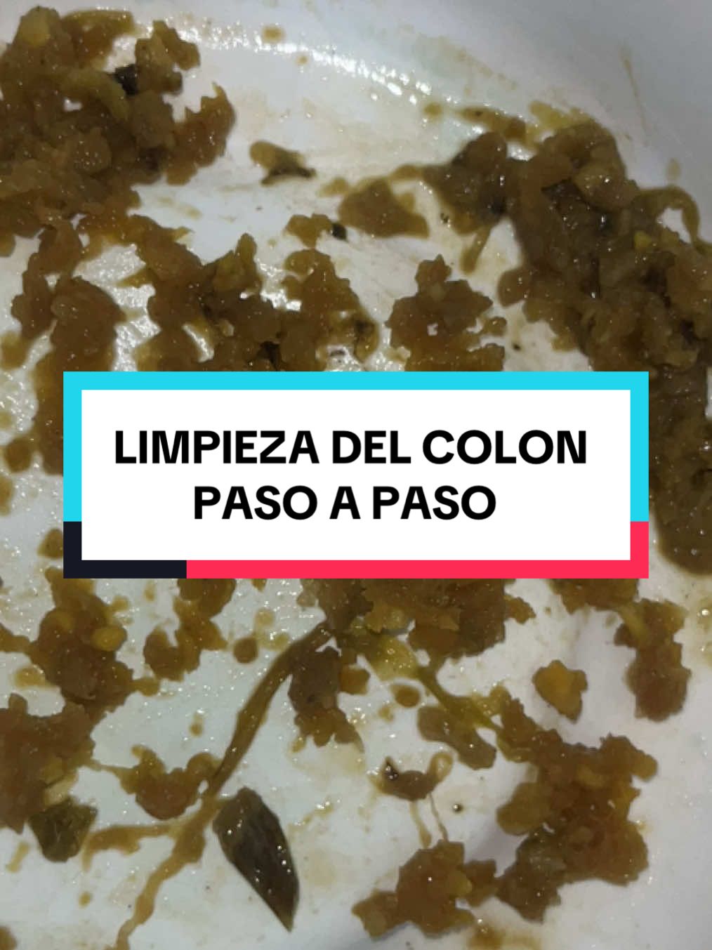 ¡Transforma tu intestino en solo 10 días! 🌿 Con esta limpieza del colon paso a paso, tu cuerpo elimina la suciedad acumulada por años, mejora la digestión y permite absorber mejor los nutrientes. Desde tomar sulfato de magnesio en ayunas, hasta tu shot mañanero de toronja, limón o naranja con aceite de oliva, cada día tu colon trabaja para liberar toxinas, gases y residuos. Además, apoyas la función natural del hígado y la vesícula, liberando grasa y piedras acumuladas, activando tu metabolismo y ayudando a bajar de peso de forma natural. 💧 Hidrátate y acompáñate con jugos verdes, té de orégano y aceite de coco. ¡Tu limpieza completa, paso a paso! #LimpiezaColon #BienestarNatural #SaludDigestiva #enitharistavargas 