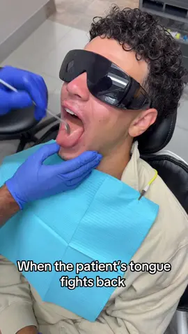 Patient’s tongue: 1 Dentist’s mirror: 0 #fyp #foryoupage #viral #Dental #DentalTok 