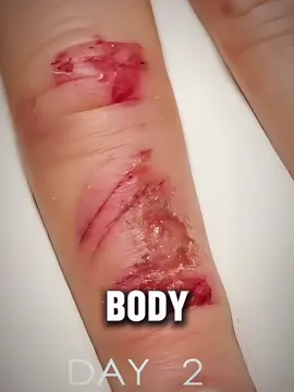 How Does Our Body Heal Itself?  (Nature’s Repair System) #medical3danimation #bodyhealing #selfhealing #immunesystem #healingpower #medicalanimation #3dmedicalanimation 