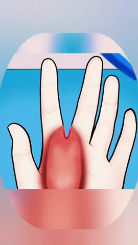 #asmrsounds #asmrsatisfy #asmrvideo #asmranimation #asmrsounds 