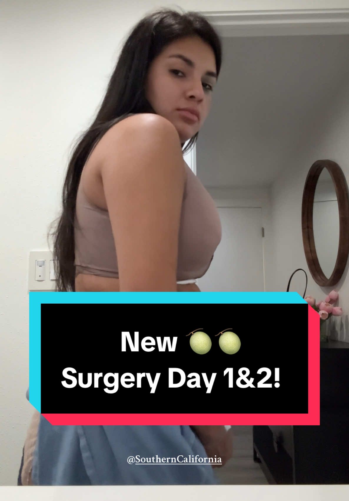 surgery day 1 & 2! 🍈🍈 Loving my results so far can’t wait for them to settle all the way!!😍  @Southern California #augmentation #lift #plasticsurgery #surgeryvlog #fyp 