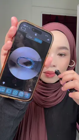 Senang lepas ni nk picit jerawat orang 😂😂