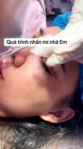 #bấmmíđẹpvĩnhviễn #nhấnmítựnhiên #chuyênnhấnmí #nhấnmí#kíchmí 