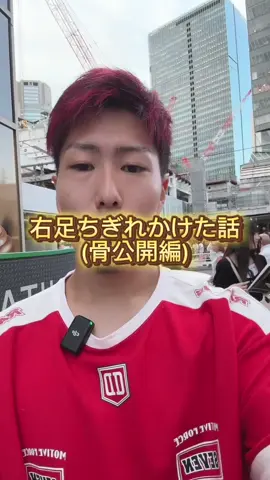 明日ついにリアルに骨公開#大事故 #大腿骨 #バイク @グリ父🟥🛵 