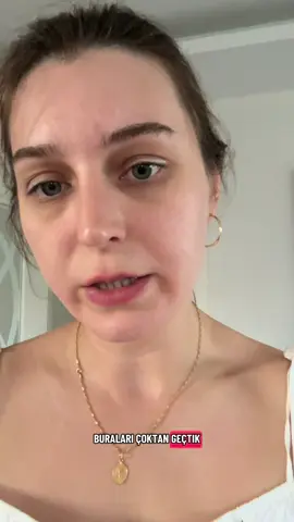 Bence bu ifade, Türkiye’de en çok alkol tüketimi olan yerlere büyük büyük pankartlarla yazılmalı çünkü belli ki çok karıştırılıyor. Bu bir yorum değil, tartışmaya ve yoruma kapalı. Video içeriği tamamen psikoeğitimden oluşmaktadır #psikolog #klinikpsikolog #f #keşfetteyiz