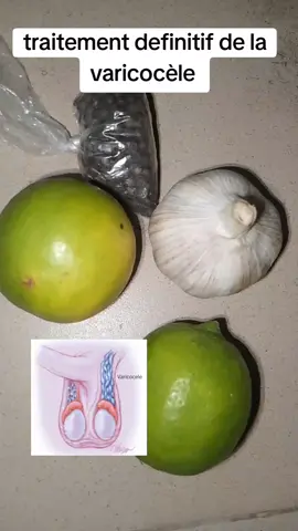 abonné et partager #vue #fyp #viral #foryou #anime 