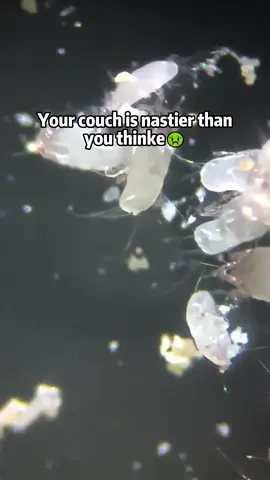 You won’t believe what’s hiding in your bed! 😰#teant #TEANT #comeback #dustmites#dustmiteallergy #TikTokShop #cleaning #mattressvacuum #deepclean #fyp #foryoupage #foryou #musthave #tiktokmademebuyit #healthyliving #homecleaning #vacuum #mattresscleaning #ShopVideoCarnival#shopvideocarnlval 