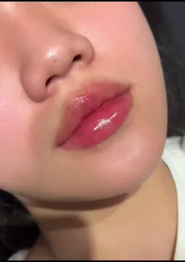 Môi tây tròn - form môi tròn gọn gàng, đỉnh môi nét căng 👄   #tiemmoi #moitay #filler 