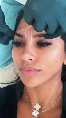 Threading & tint 💋 Excuse my black eye & hyperpigmentation 🐼 #fyp #eyebrows #threading @Browessence 