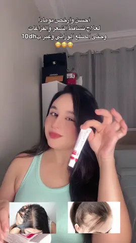 #تساقط_الشعر #تساقط_الشعر_وعلاجه #تطويل_الشعر #explore #viral 