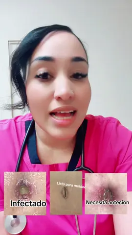 ✨ El ombligo no es solo estética, ¡es salud! ✨ Después de una cirugía estética, tu ombligo necesita cuidados especiales: 💧 Limpieza suave con solución estéril 🩹 Parches médicos y gasas limpias 🚫 Nada de cremas, aceites ni remedios caseros ⚠️ Vigila signos de alarma: enrojecimiento, mal olor o secreción 👉 Un ombligo bien cuidado evita complicaciones y garantiza mejores resultados. En Principessa Med Spa somos expertos en curación médica postquirúrgica. 🚫 Qué evitar después de tu cirugía estética ✔️ No retires costras antes de tiempo (pueden dejar cicatriz o abrir la herida). ✔️ No te sumerjas en piscinas, jacuzzis ni bañeras hasta que tu médico lo autorice. ✔️ No te automediques con antibióticos o ungüentos sin supervisión. 💧 Usa siempre soluciones antisépticas médicas recomendadas por tu cirujano y productos de plata especializados, que ayudan a prevenir infecciones y aceleran la cicatrización. ⚠️ Signos de alarma Consulta de inmediato a tu cirujano si notas: • Enrojecimiento, calor excesivo o hinchazón • Mal olor o secreción amarillenta/verdosa • Dolor intenso que no mejora con analgésicos • Fiebre 👉 En Principessa Med Spa cuidamos tu recuperación con protocolos médicos especializados, porque tu salud siempre está primero.      📍 1415 Commercial Park Dr, Lakeland, FL 📞 (añadir número) #PrincipessaMedSpa #PostOperatorioSeguro #Lipo #TummyTuck #BBL@Lakeland Florida @polkcountyfl @Milena Mi genteee @La cubana y el gringo 🇨🇺🇺🇸 @Cubaneando por el mund0🇨🇺 @CUBANOS POR TODO EL  MUNDO 