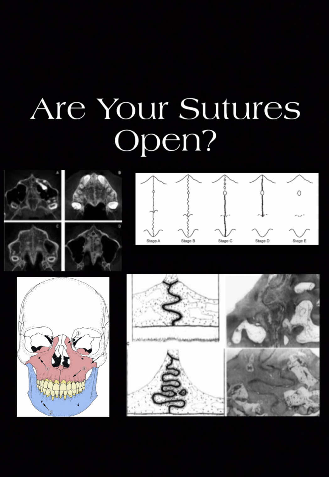 Let’s go over sutural development… #information #beauty #face #Science 