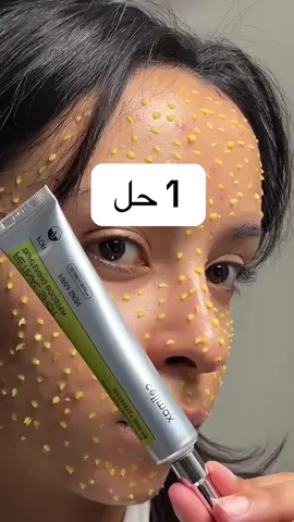 ✨ بشرتكِ تستحق العناية 🌸 مع عصارة الريتانال من سليماكس استعيدي النضارة، الصفاء، والإشراقة الطبيعية 💖 النتيجة تُرى من الاستخدام الأول، وستحبين مظهرك أكثر كل يوم 🌹: #سليماكس #ريتـانال #عناية_بالبشرة #جمالك #بشرة_صافية   
