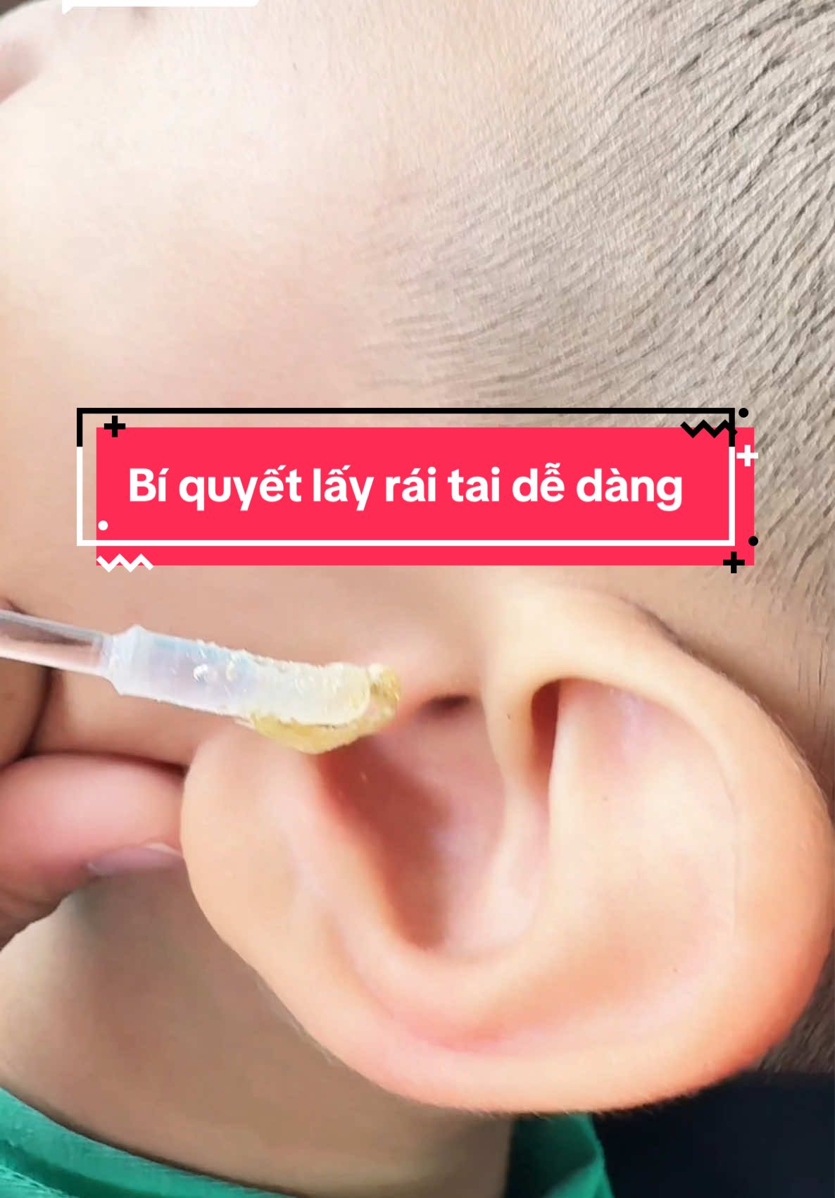 Trả lời @Thỏtrắng2k4 bám chặt cỡ nào em dụng cụ này cũng giúp được hết #xuhuớng #riomiorìdiu #dungculayraytai #layraitai #chobe  @Mẹ Rio Mio rì diu  @Mẹ Rio Mio rì diu  @Mẹ Rio Mio rì diu 