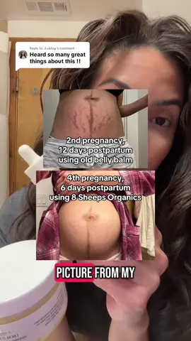 Replying to @𝓐𝓼𝓱𝓵𝓮𝔂 I’ve been telling all my pregnant and postpartum mom friends to use this bundle from @8 Sheep Organics 💗 #8sheeporganics #stretchmarks #stretchmarktreatment #postpartumbody #babyshowergifts 