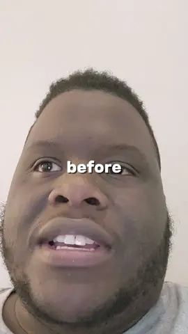 That face to face different  #CapCut #ambleptnr #ambleptnr #viralvideo #beforeandafter 