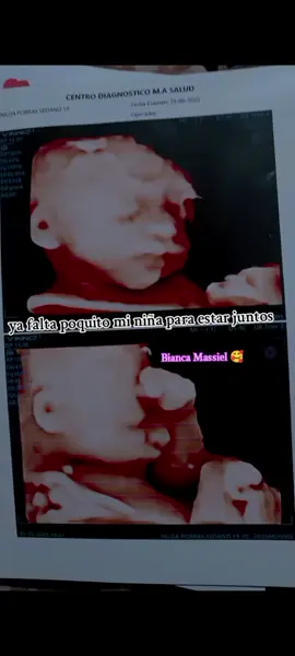 #Mi #princesa #Bianca #Massiel 👑🥺