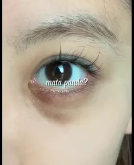 jadi ga insecure lagi semenjak pake eye serum 😗😗  #fyp #fypage #fypdong #tiktokpelitfyp #face #eye #serum #cream #mata #panda #insecure #skin #glowing #girl #korea #beauty #viral 