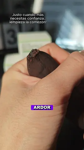 #Balanitis #TratamientoEficaz #AlivioRápido #CuidadoIntimo #Salud 