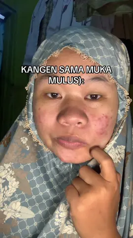 bangettt#acnefighter #jerawatan #mukamulus #masukberanda 