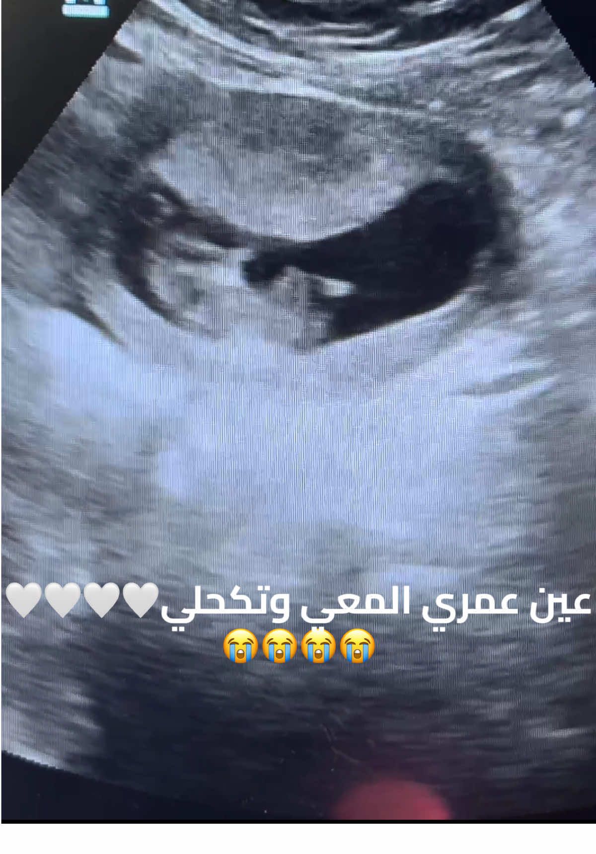 #قشعريرة #شيمي #اكسبلور #استخدموا_الصوت #مبروك 