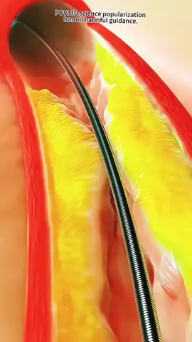 remove sugar from your end 😔 and I have to do a lot of March I think 🧐🧐 and #foryou #trending #viral #diabetes #health 