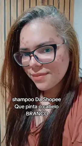 🧴✨ Shampoo Tonalizante 3 em 1 ✨🧴 Cubra os fios brancos com praticidade e estilo! ✔️ Cobre os cabelos brancos já na primeira aplicação ✔️ Lava, trata e tonaliza ao mesmo tempo ✔️ Fórmula segura, sem amônia e sem agredir os fios ✔️ Resultado natural e duradouro 💁‍♀️ Ideal para quem quer praticidade e beleza no dia a dia! 📦 Receba no conforto da sua casa! 🟢 Comente “EU QUERO” ou clique no link da bio para garantir o seu!#cabelosbrancos #shampoo #tonalisante 