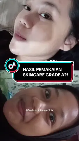Mana nih hasil kalian?? Sudah ada perubahan apa belum?? #lotiongradeabytmco #gradeabytmcoskincare #brandlokalindonesia #tiktokshop #gradeabytmco 