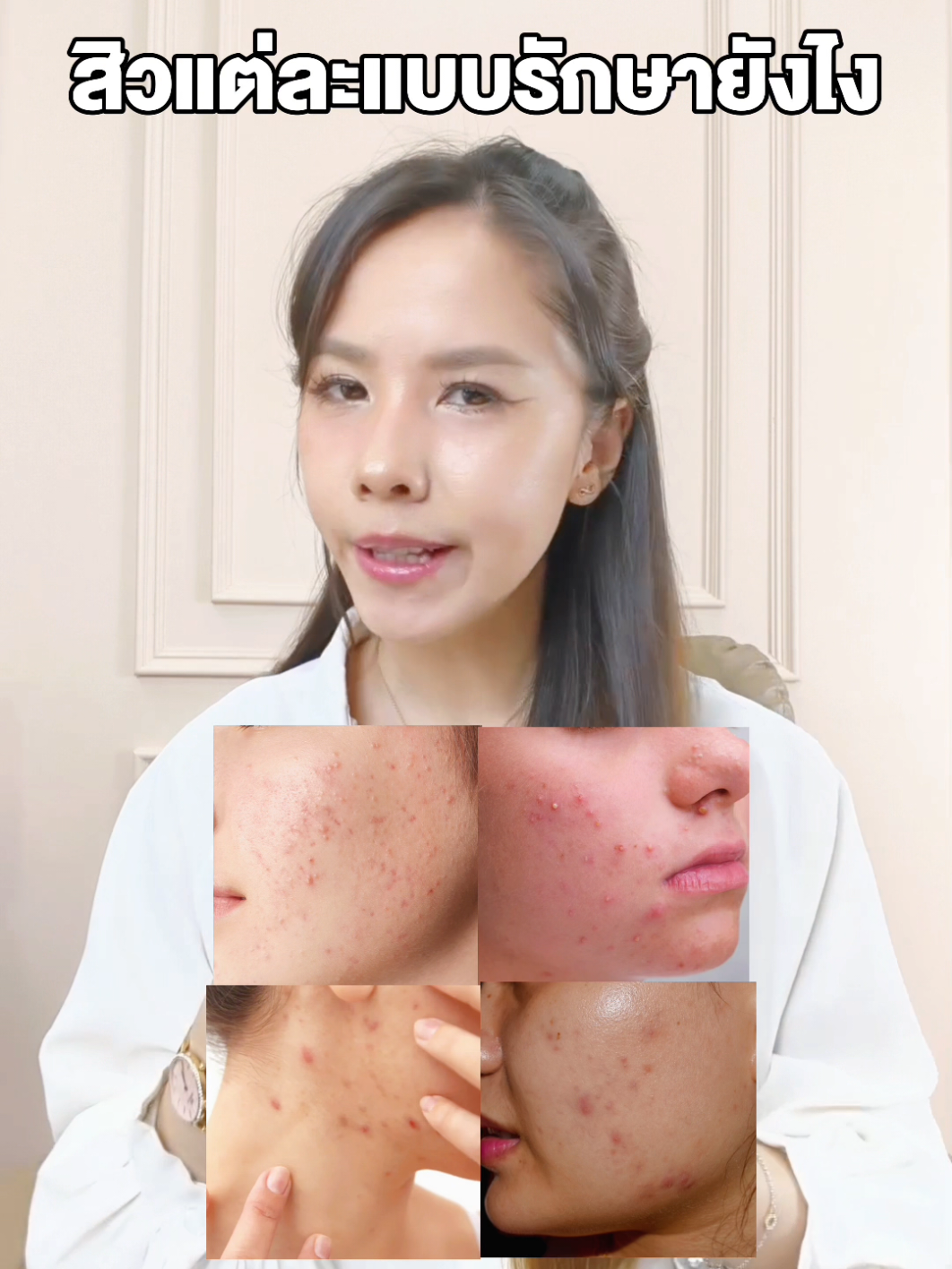 สิวแต่ละแบบดูแลแบบไหน #สิว #rukskin #ฮีลsession #เภสัชรักนักซ่อมผิว #เซรั่มแดงrukskin 