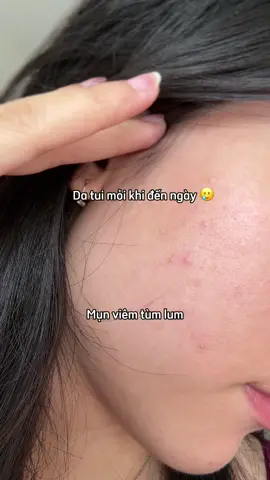 #colorkeyvn #colorkeyluminous #matnaden #matnatraxanh