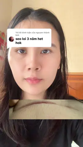 Trả lời @nguyen thành linh chị xem hết video để xem vết sẹo mổ của e nhé, c ấn vào spham tham khảo thêm phản hồi của mọi người đã dùng có đó ạ #doxinhthitkhotau #xuhuongtiktok #kemtriseo  @Đồ xinh thịt kho tàu  @Đồ xinh thịt kho tàu  @Đồ xinh thịt kho tàu 