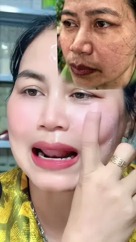 #xuhuong #nám #tannhang #sạmda . Chị em cho bong da để có làn da đưpj nha 