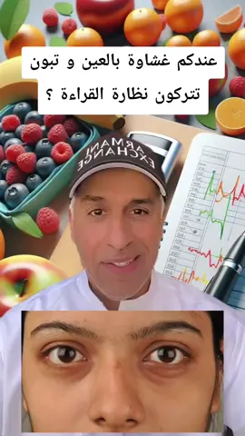 عندكم غشاوة بالعين و تبون تتركون نظارة القراءة ؟ #اكسبلور #علاج_طبيعي #صحة_عامة #غشاوة_في_النظر #fyp 