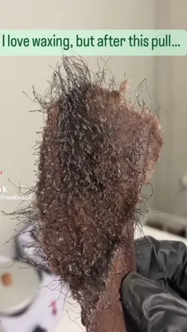 from hairy to smooth goddess + dah tak payah #wax atau #shave #UlikeAir2Max #UlikeHairRemoval #UlikeBeautyTech