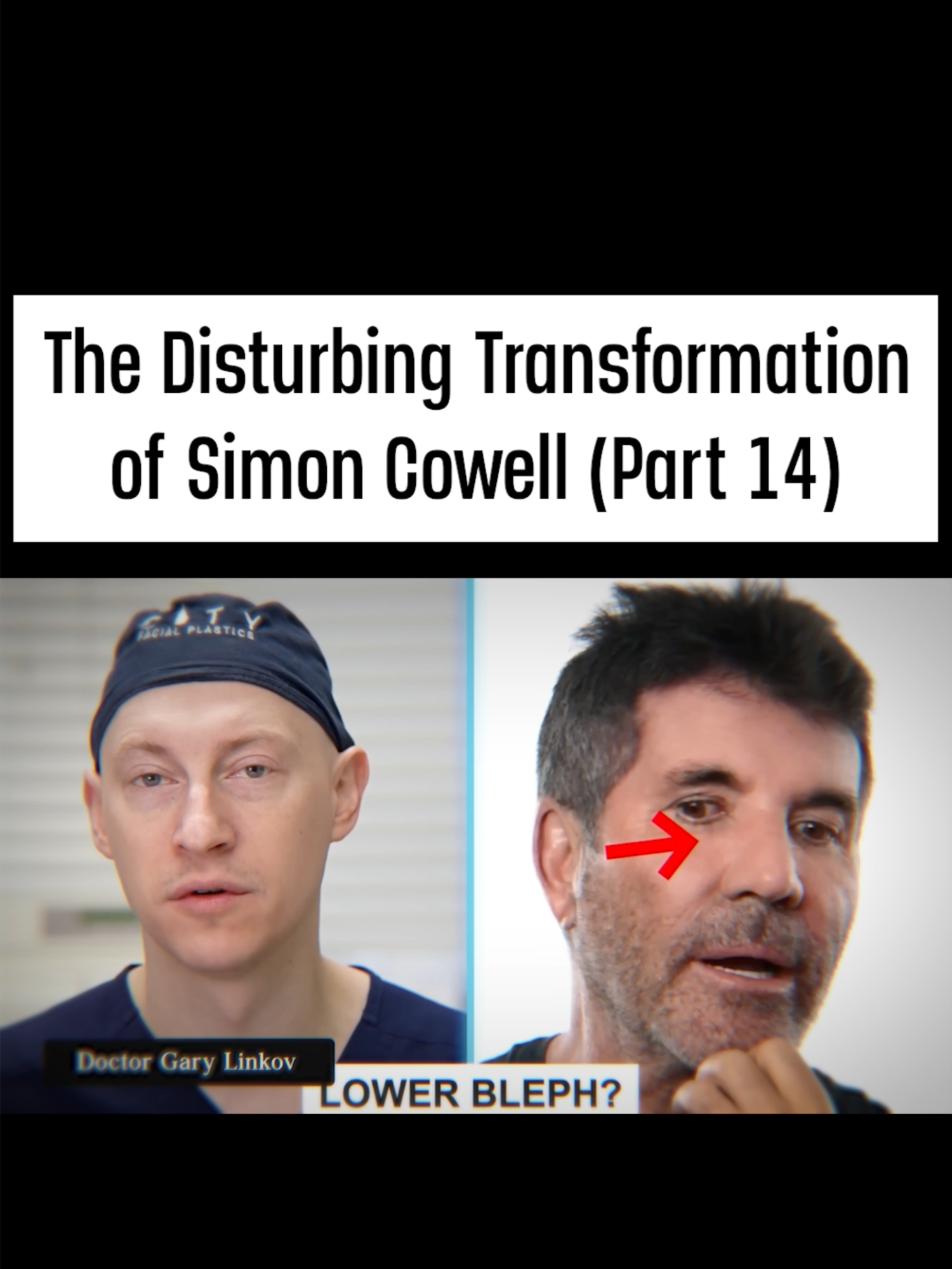 The Disturbing Transformation of Simon Cowell (Part 14) #simoncowell #thexfactor #americanidol #americasgottalent #britainsgottalent