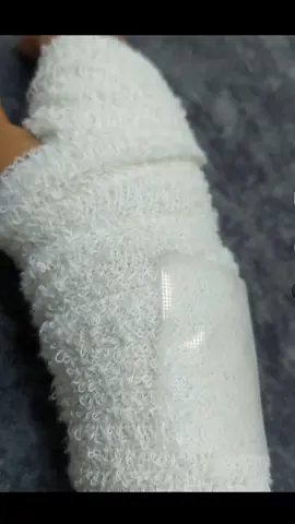 العافيه يا خليف😔💔#يد #اكسبلور #اصابه #اكسبلورexplore 