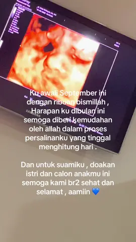 Yang samaan HPL nya bulan September .. semoga kita semua bisa berjuang sama